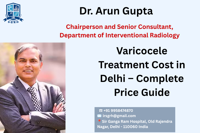 Varicocele Treatment Cost Delhi