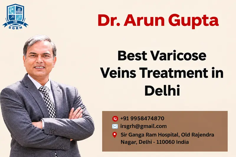 Best Varicose Veins Treatment in Delhi