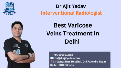 Best Varicose Veins Treatment in Delhi
