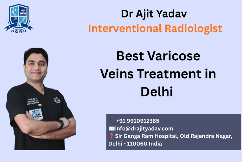 Best Varicose Veins Treatment in Delhi