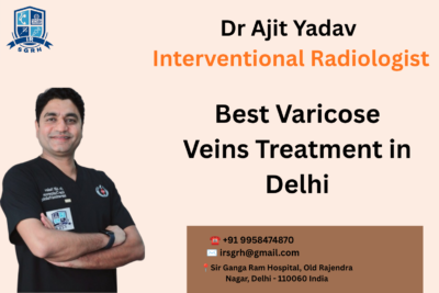 Best Varicose Veins Treatment in Delhi Best Varicose Veins Treatment in Delhi