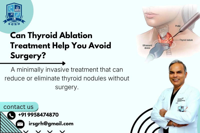 Thyroid Ablation vs Surgery