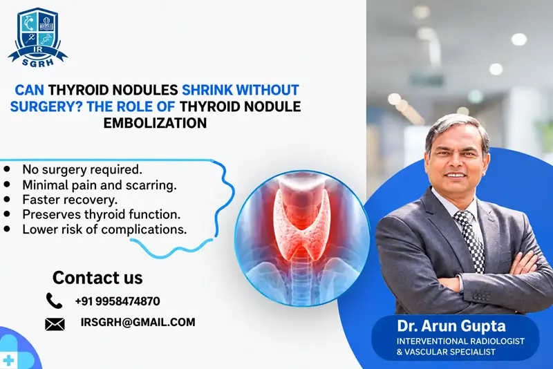 Can-Thyroid-Nodules-Shrink.webp