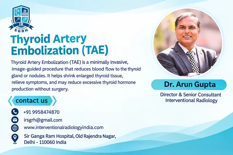 Thyroid Artery Embolization in Delhi