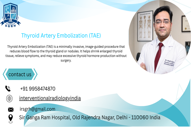 Thyroid Artery Embolization in Delhi