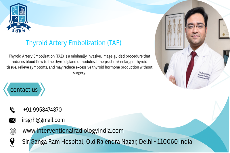 Thyroid Artery Embolization in Delhi