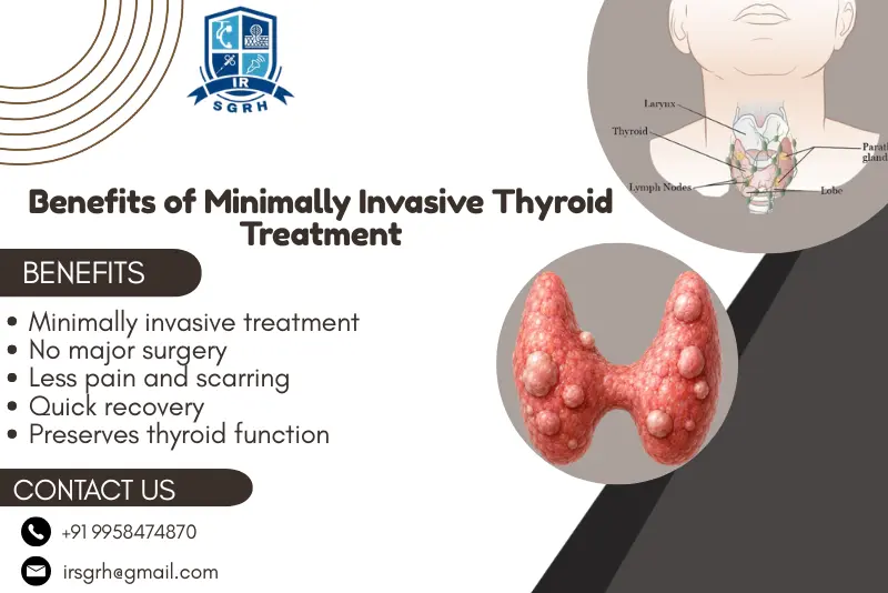 Thyroid Nodule RFA in Delhi