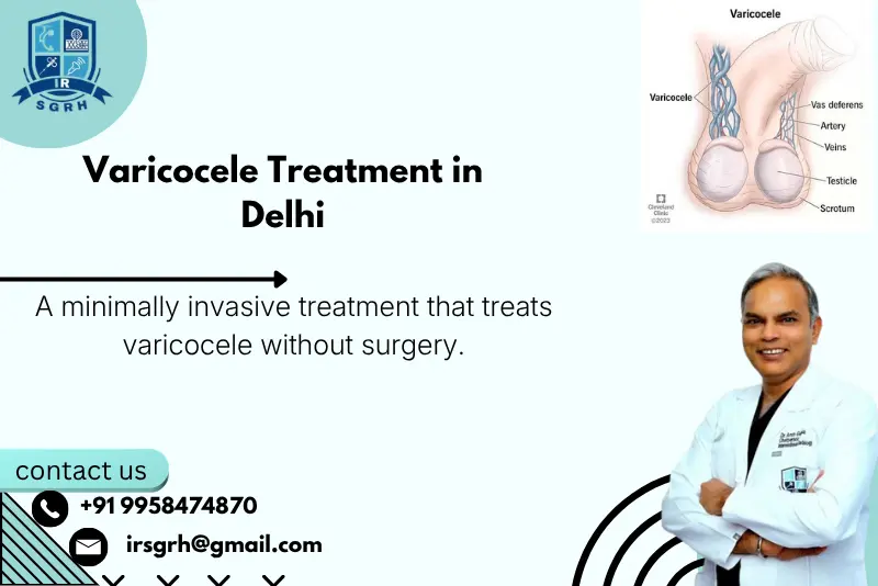 Varicocele Treatment Without Surgery in delhi