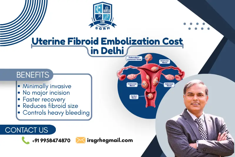Uterine Fibroid Embolization Cost in Delhi