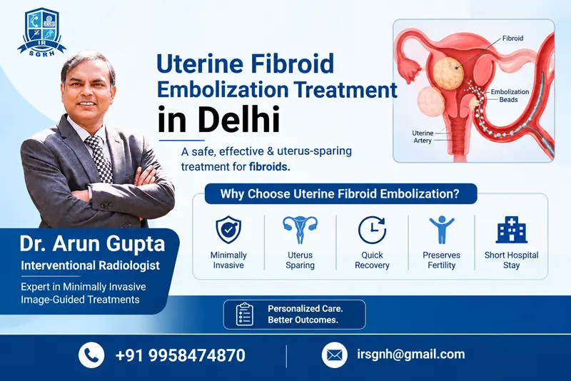 Uterine Fibroid Embolization Treatment in Delhi