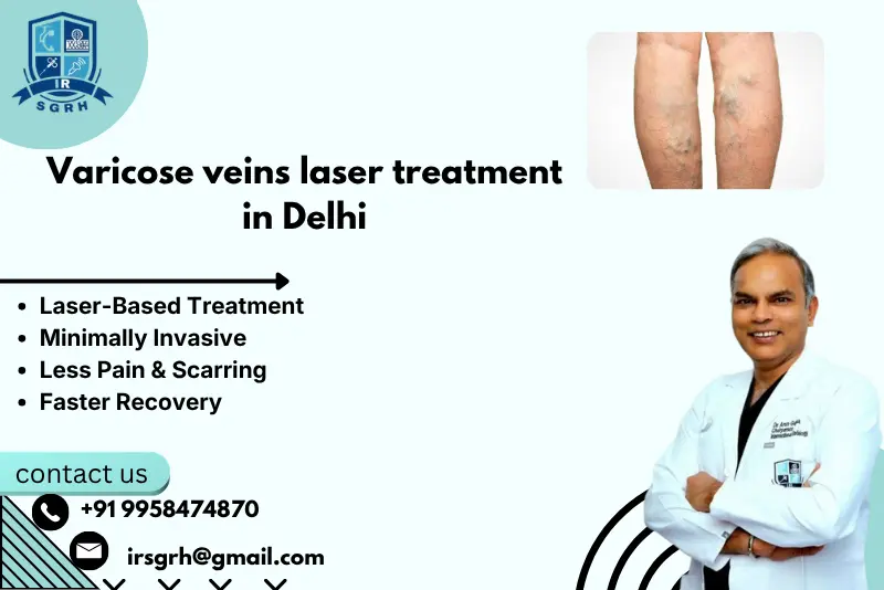 Varicose veins laser treatment in Delhi